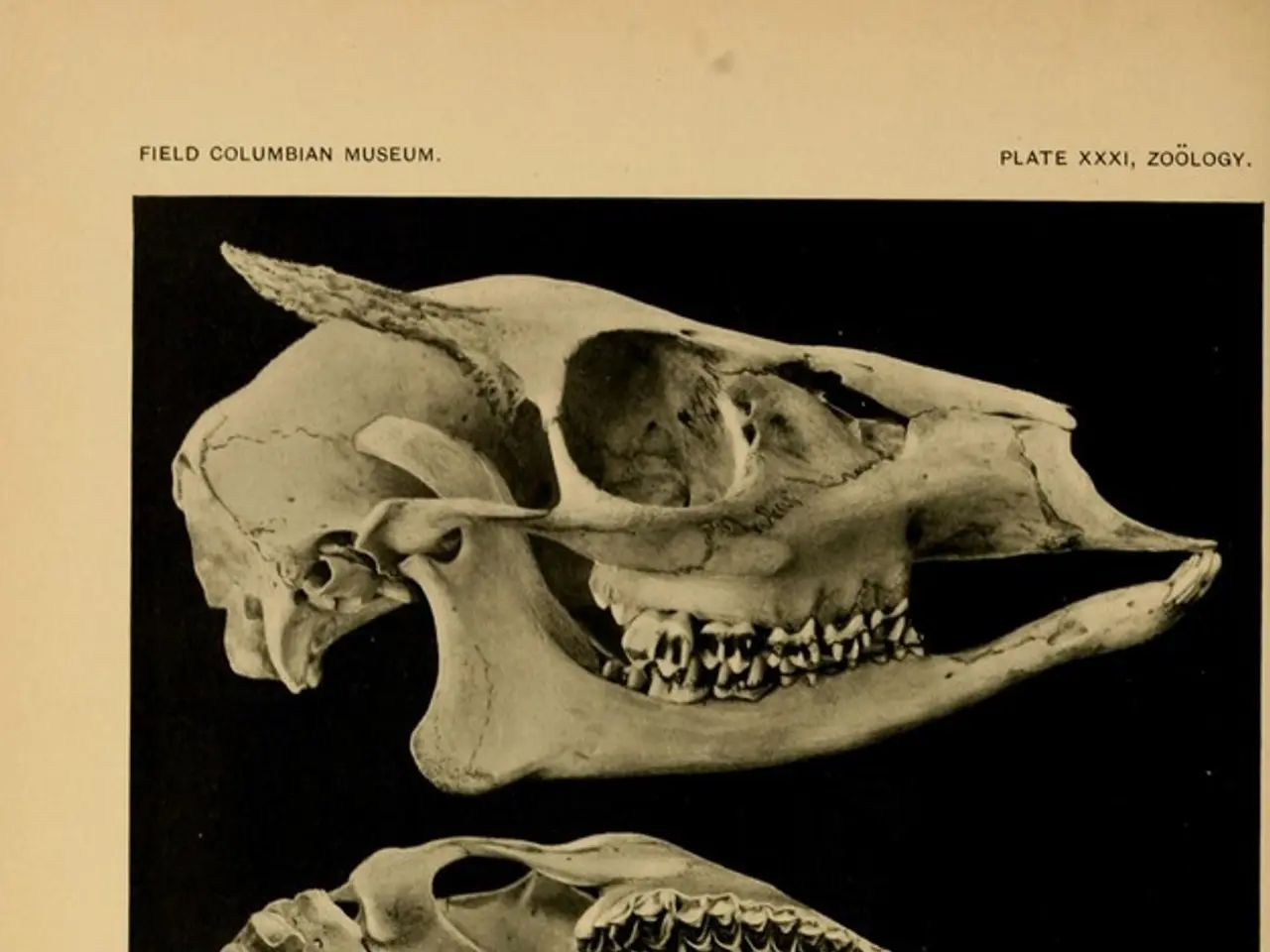 Exploring the Enigmas of Brain Tumors: Insights from Dr. Rao's Expertise
