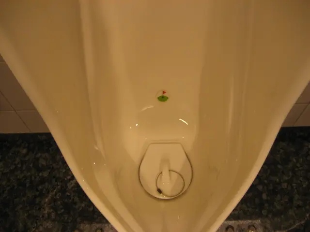 Urinary Tract Infections (UTIs) Frequently Linked with Pyuria, Their Main Connection Explored