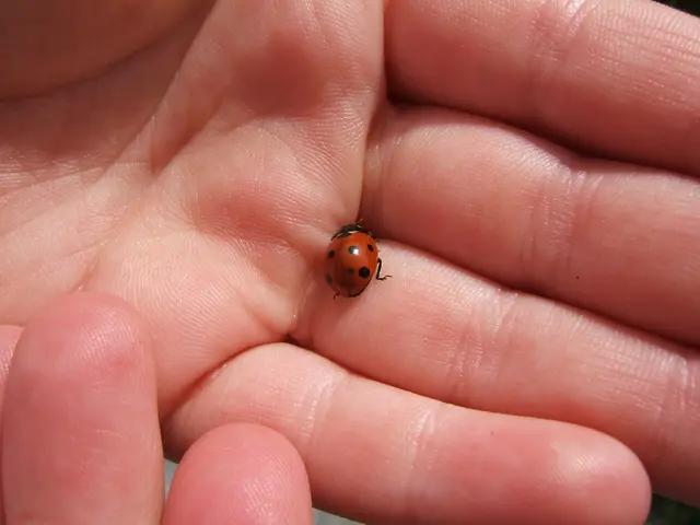 Adult Onset of Hand, Foot, and Mouth Disease: Recognizing Symptoms and Possible Remedies